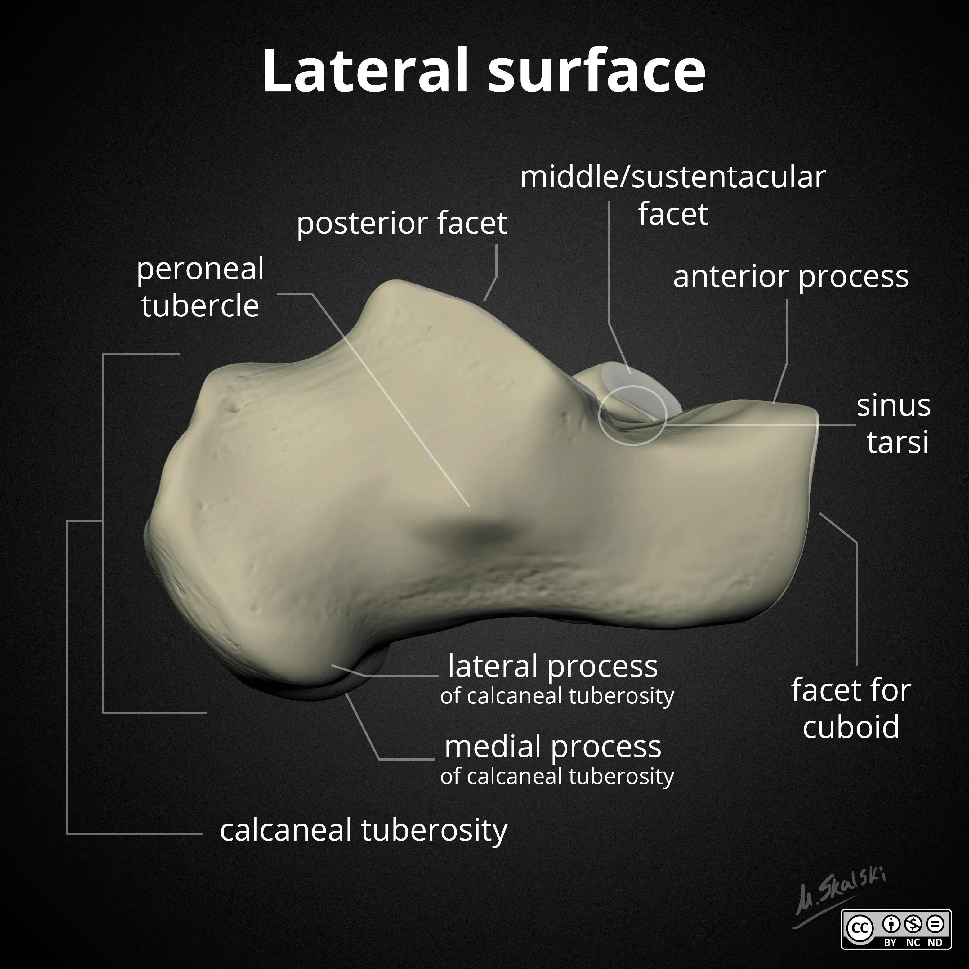 Таранная кость. Calcaneus анатомия. Пяточная кость, os calcaneus. Талус анатомия. Nase calcaneus анатомия.