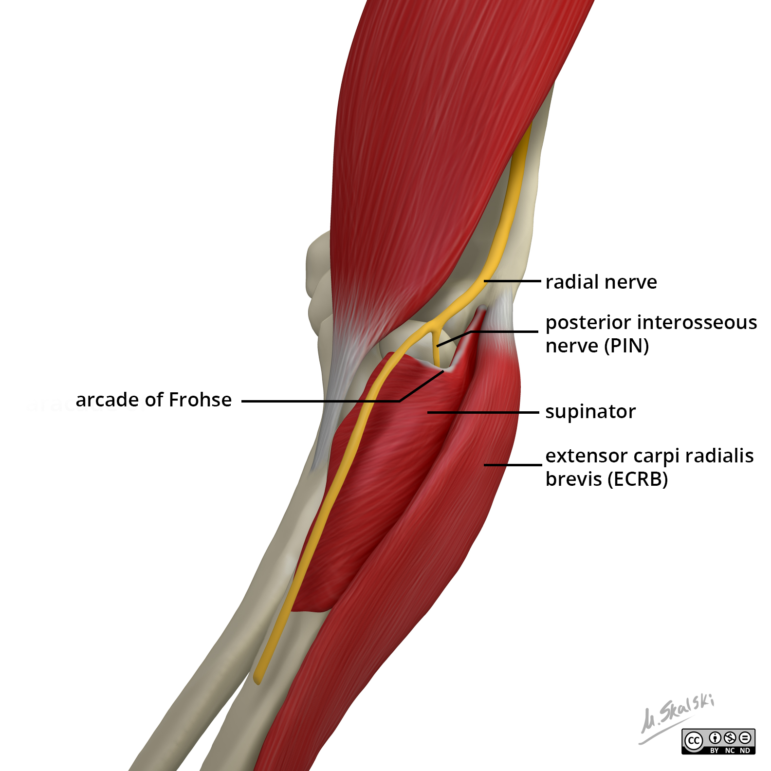 Radiopaedia Drawing Radial Nerve At Elbow English Labels Anatomytool 2547