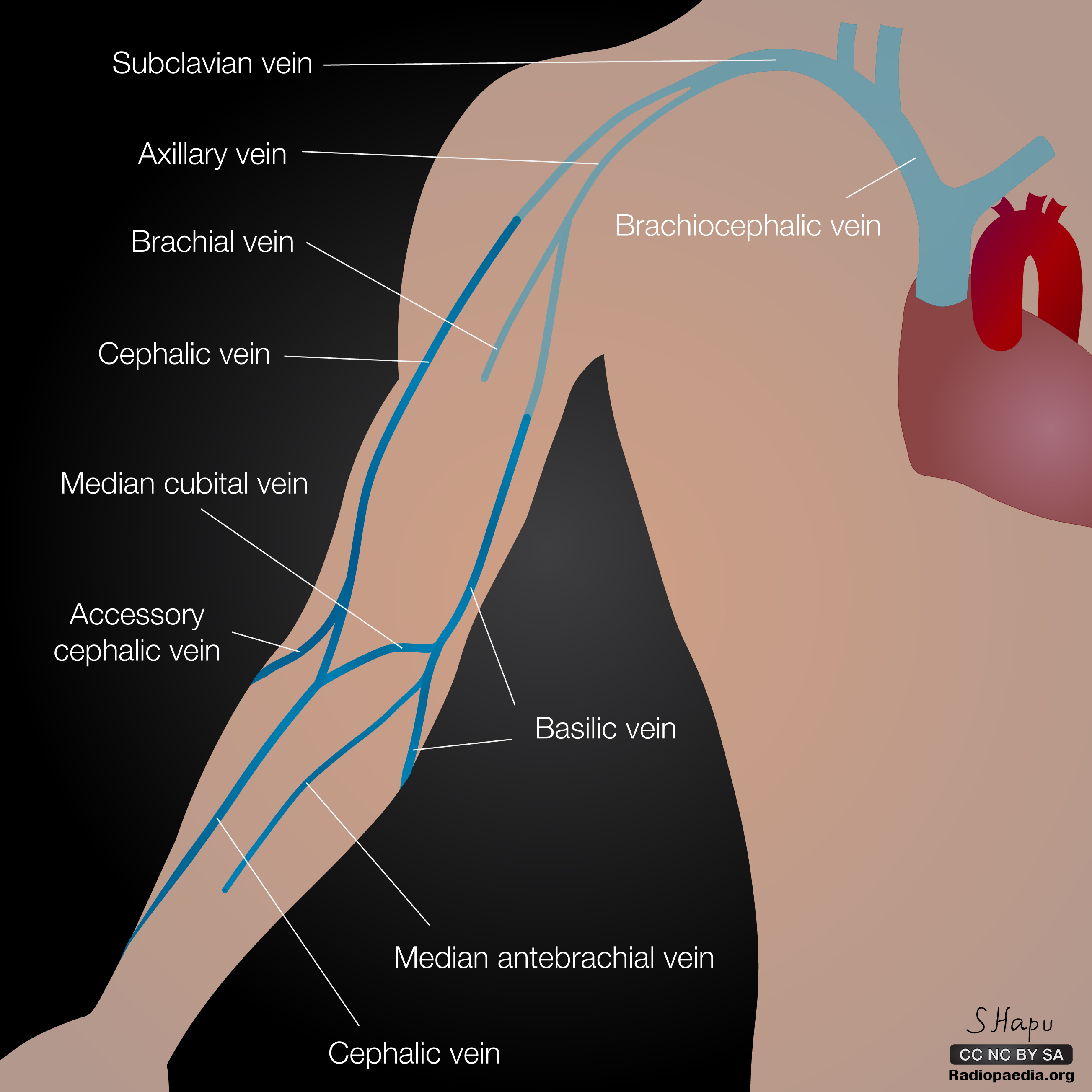 radiopaedia-drawing-upper-limb-veins-english-labels-anatomytool