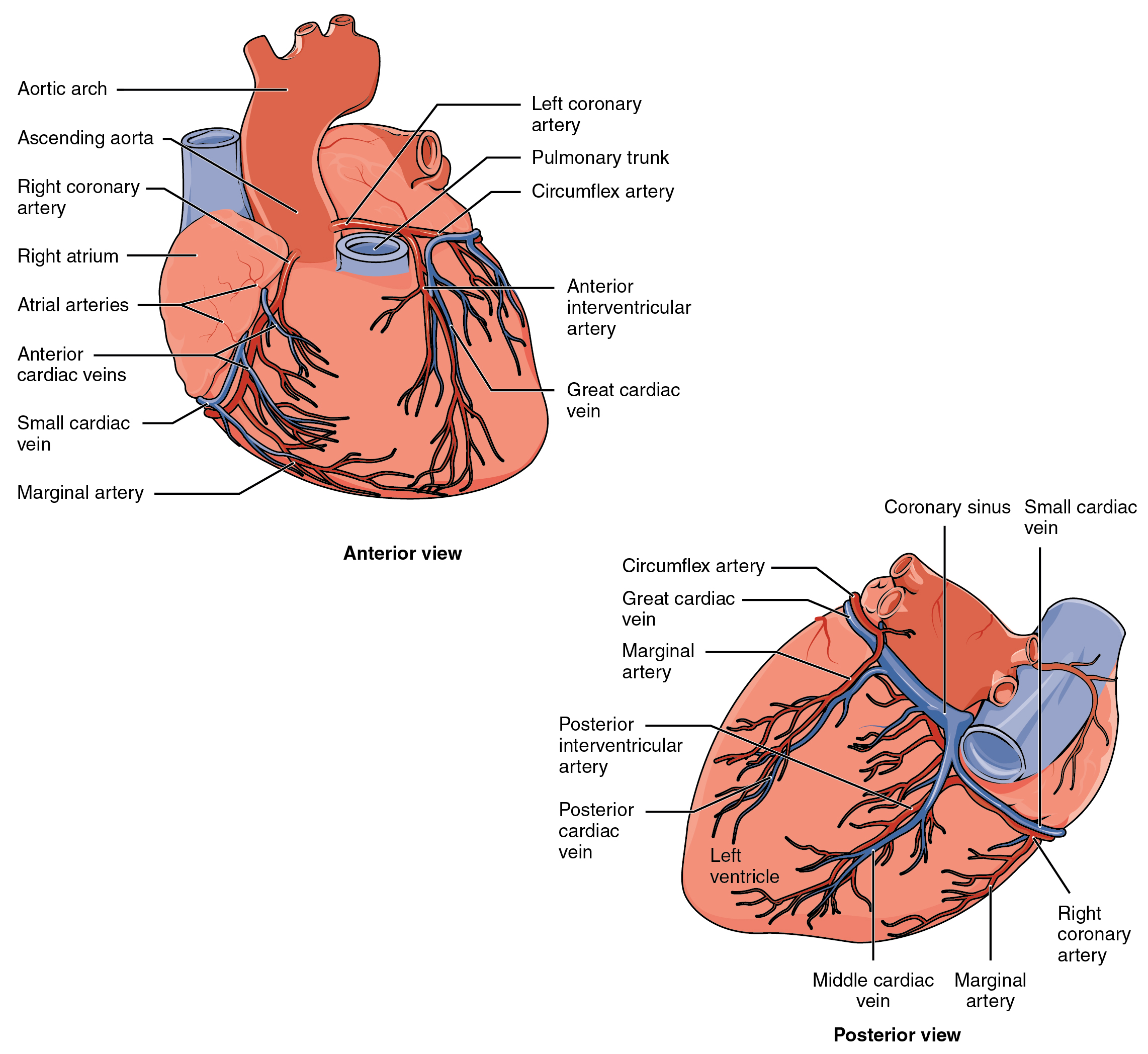 What Is Severe 3 Vessel Coronary Artery Disease