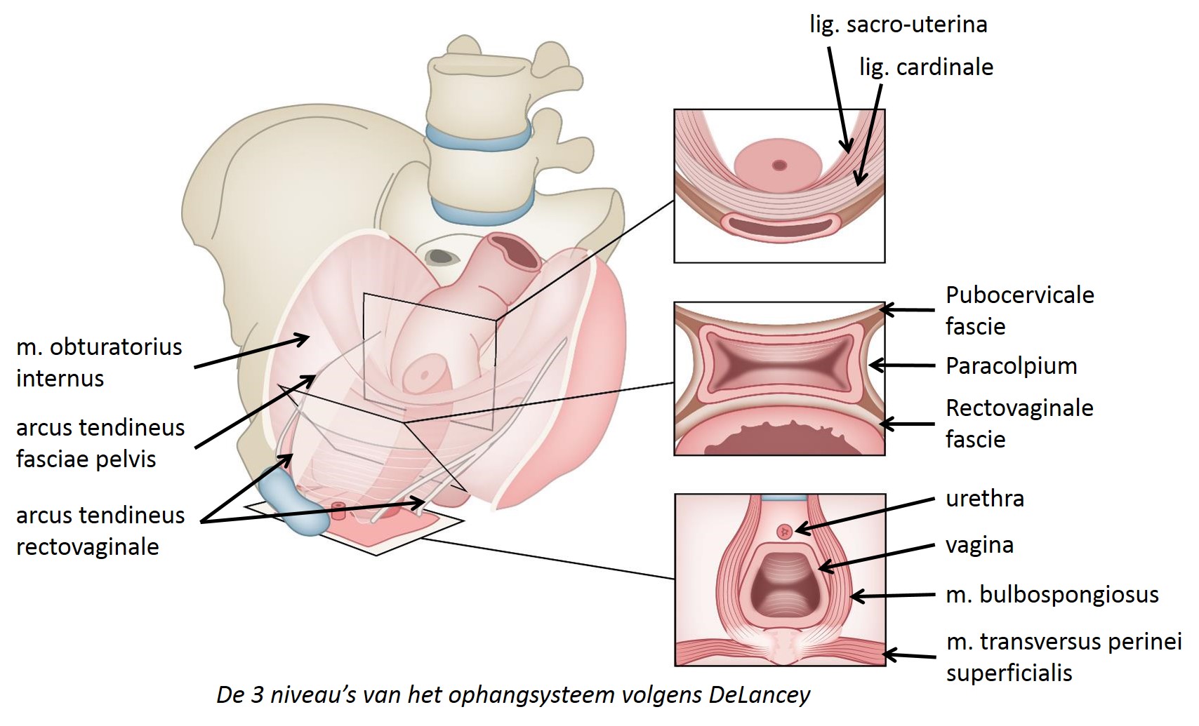 Delancey's three levels of pelvic support – Dutch lables