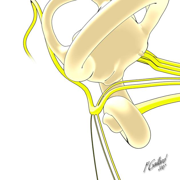 Radiopaedia - Drawing Main branches of the mandibular nerve - English  labels