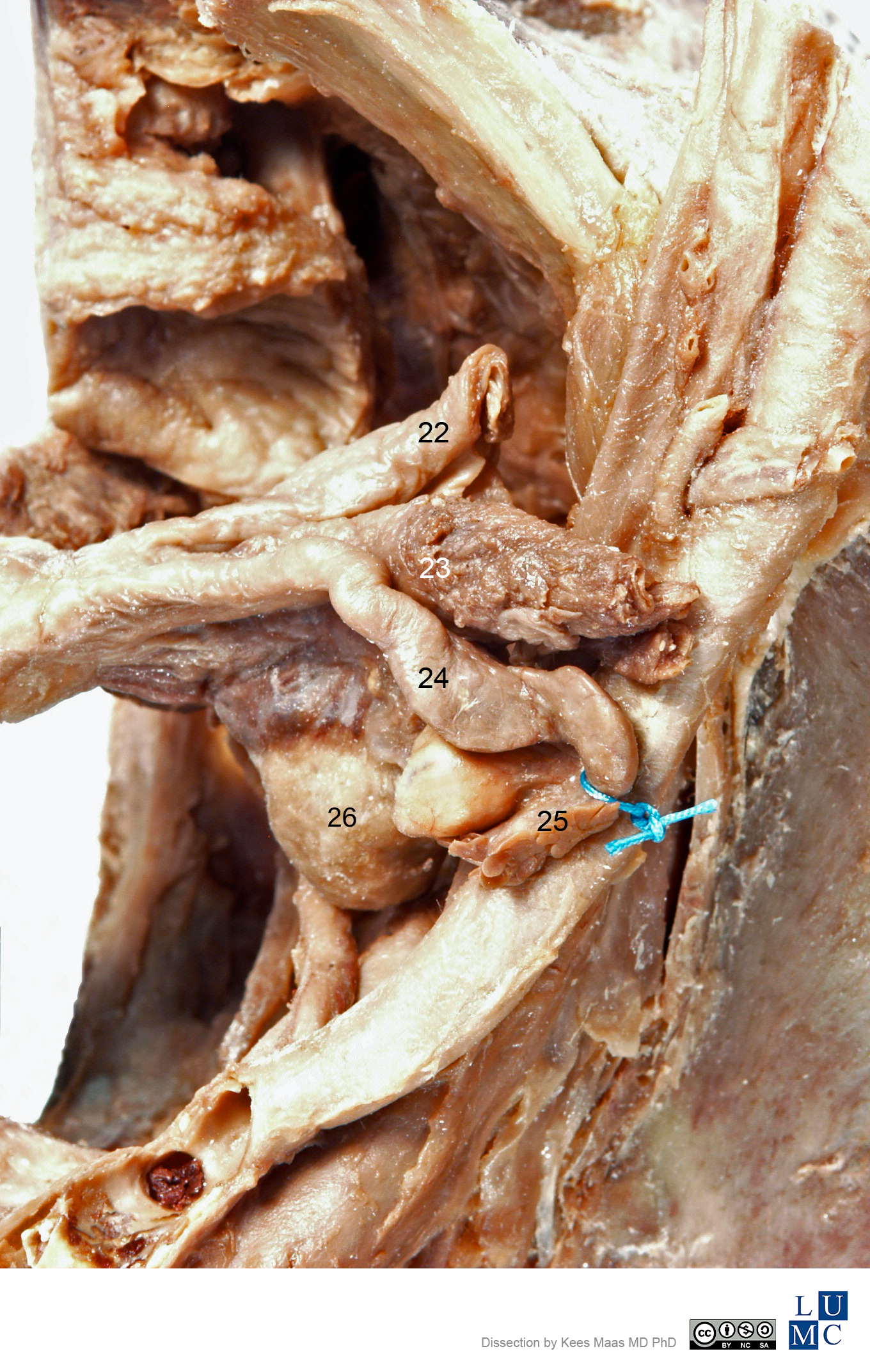 Leiden Maas Photo 23 Superior View Of The Adnexa Of Uterus Plastination Specimen Number Labels Anatomytool