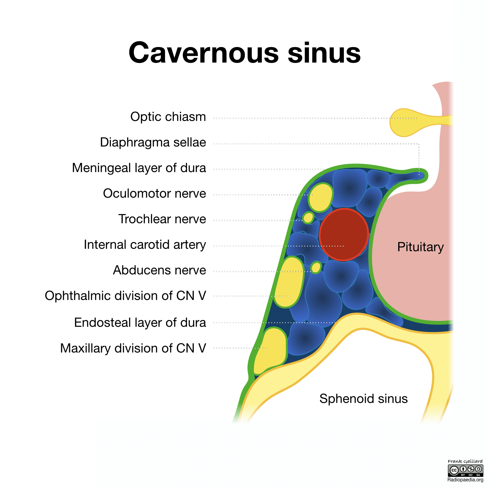 Radiopaedia Drawing Contents of the cavernous sinus English labels