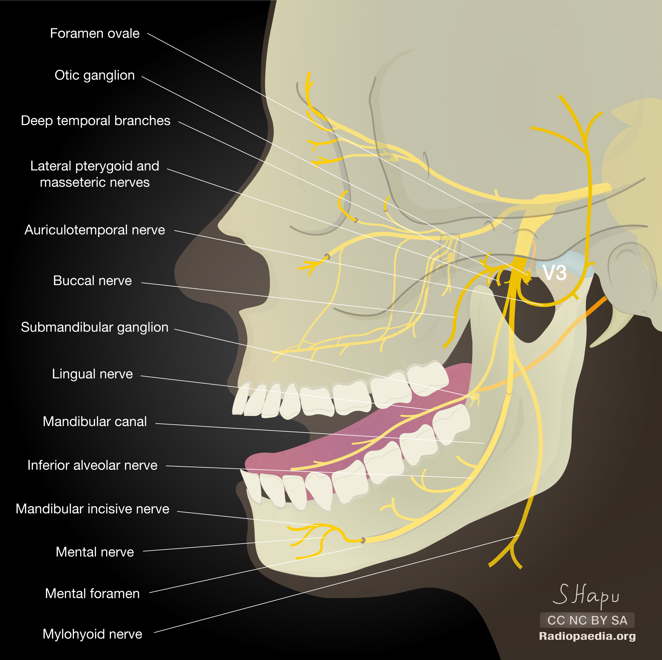 Radiopaedia - Drawing Main branches of the mandibular nerve - English  labels
