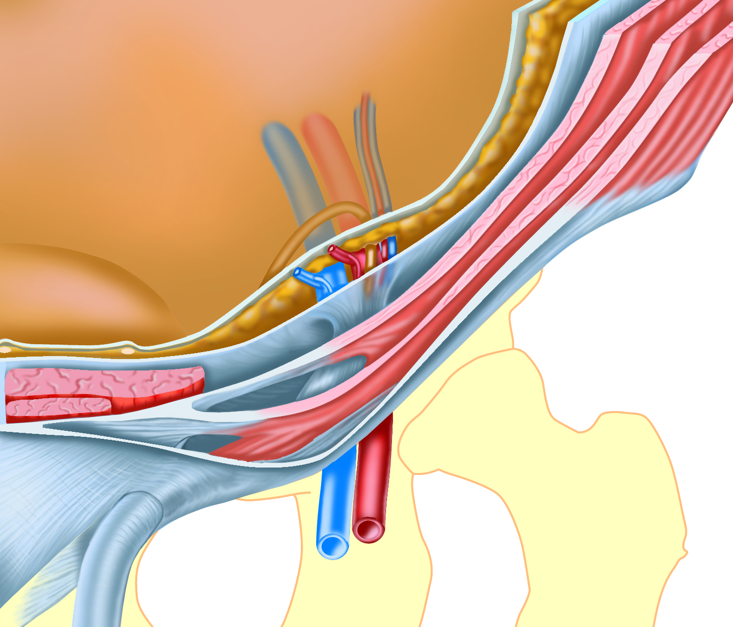Abdominal wall layers of the inguinal canal, semi 3D exploded view, no  labels