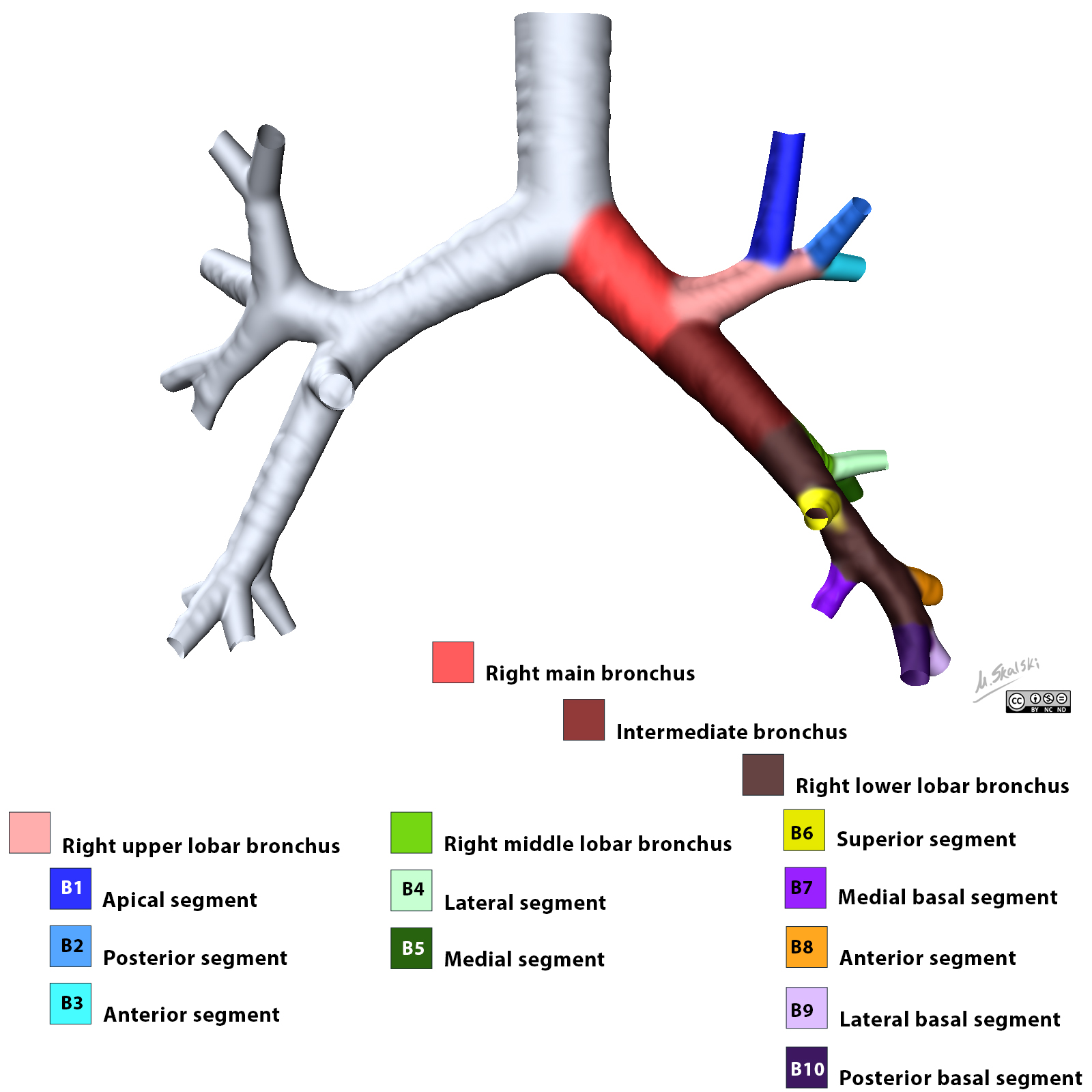 Radiopaedia - Drawing Right Bronchial Tree From Posterior - English 