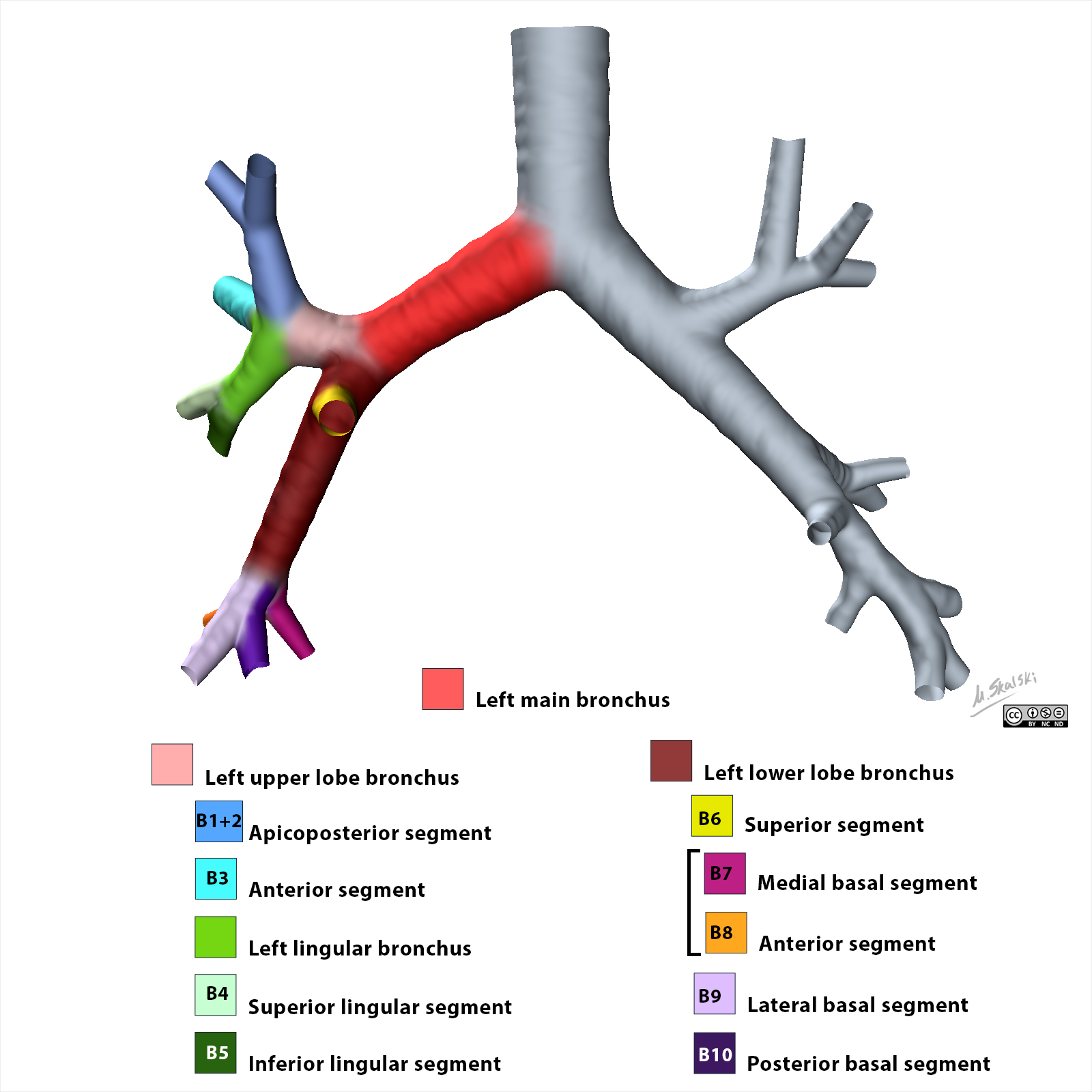 Radiopaedia - Drawing Left bronchial tree from posterior - English ...