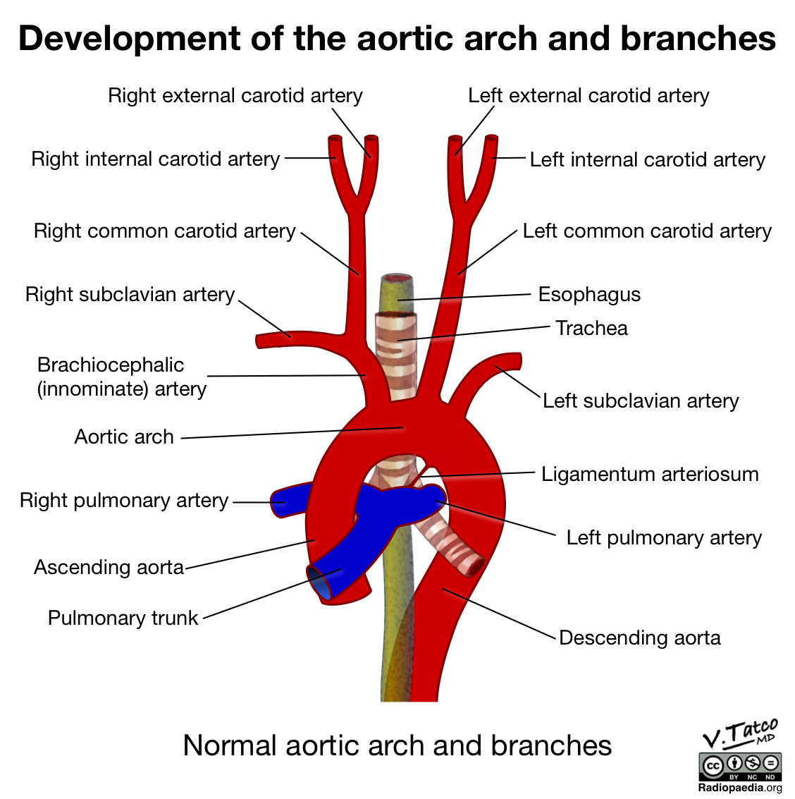Branches If The Aortic Arch Arteries Anatomy Medical Anatomy Human | My ...