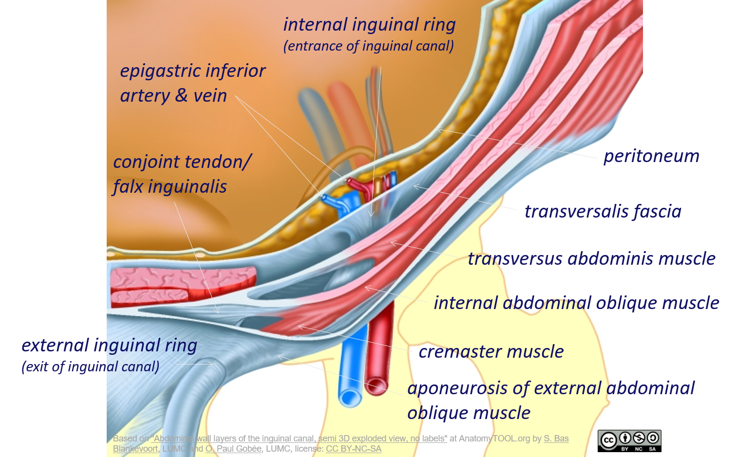 Abdominal wall layers of the inguinal canal, semi 3D exploded view -  English labels