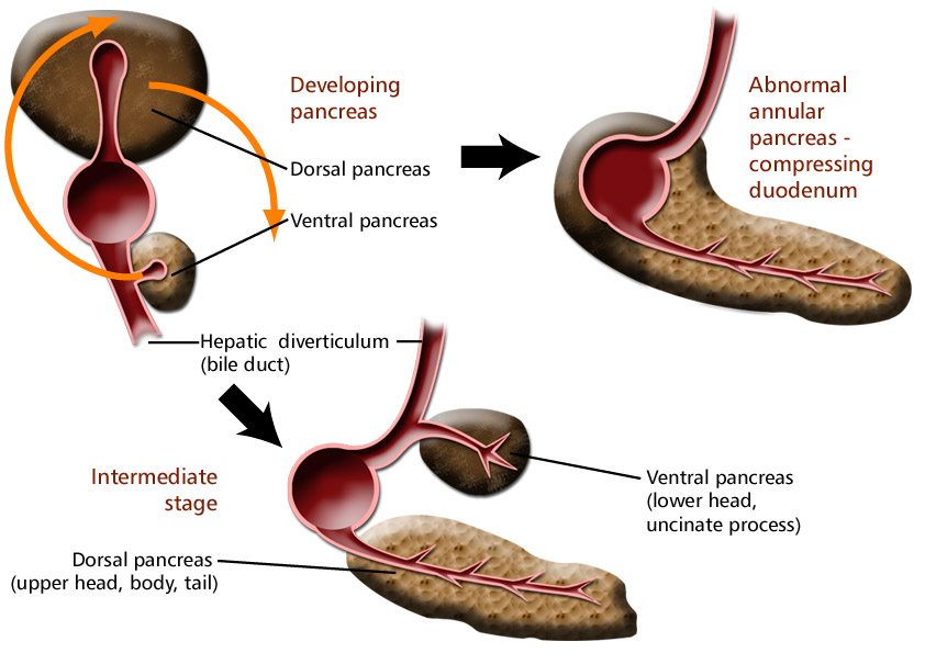 The pancreas from a surgical perspective: an illustrated overview