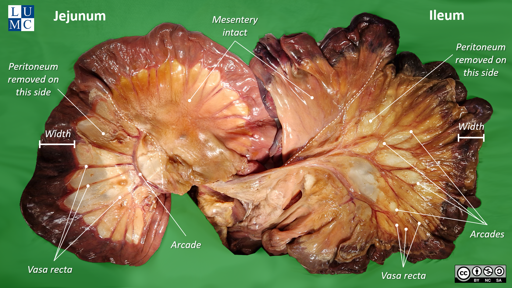 Leiden - Photo Characteristics jejunum and ileum (dissection) - English labels