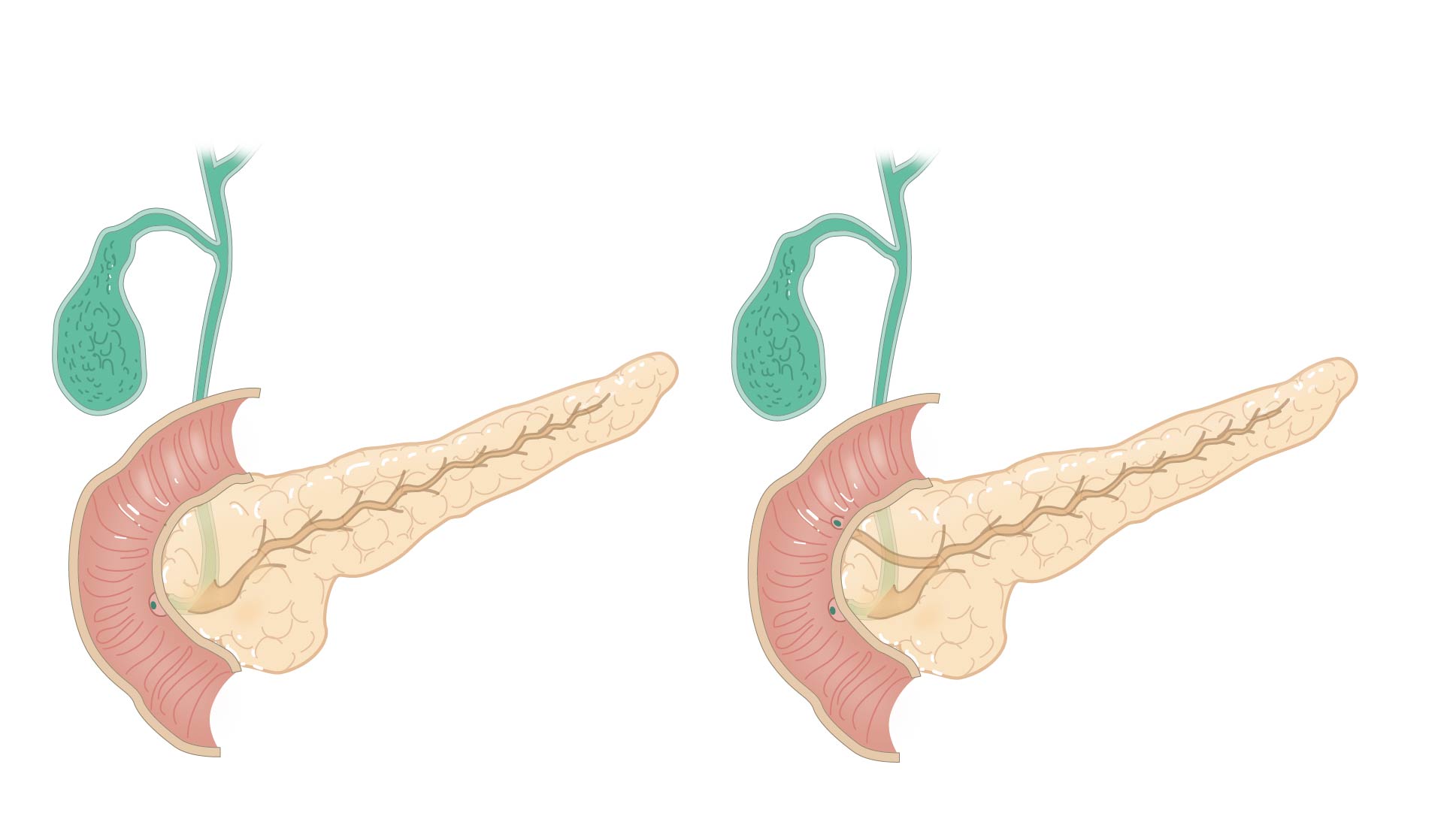 Slagter - Drawing Biliary system and pancreatic duct - no labels