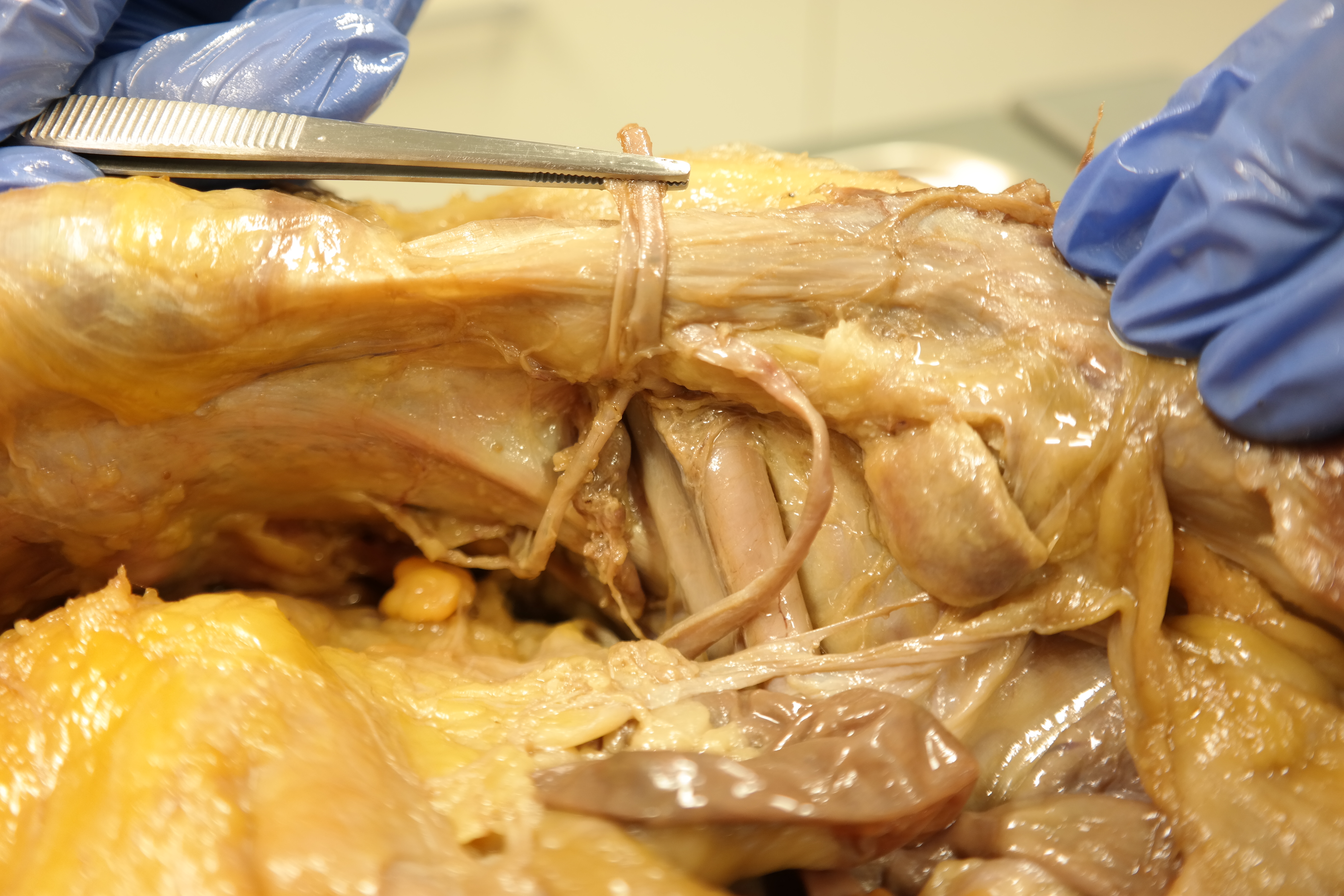 photo internal view female inguinal region