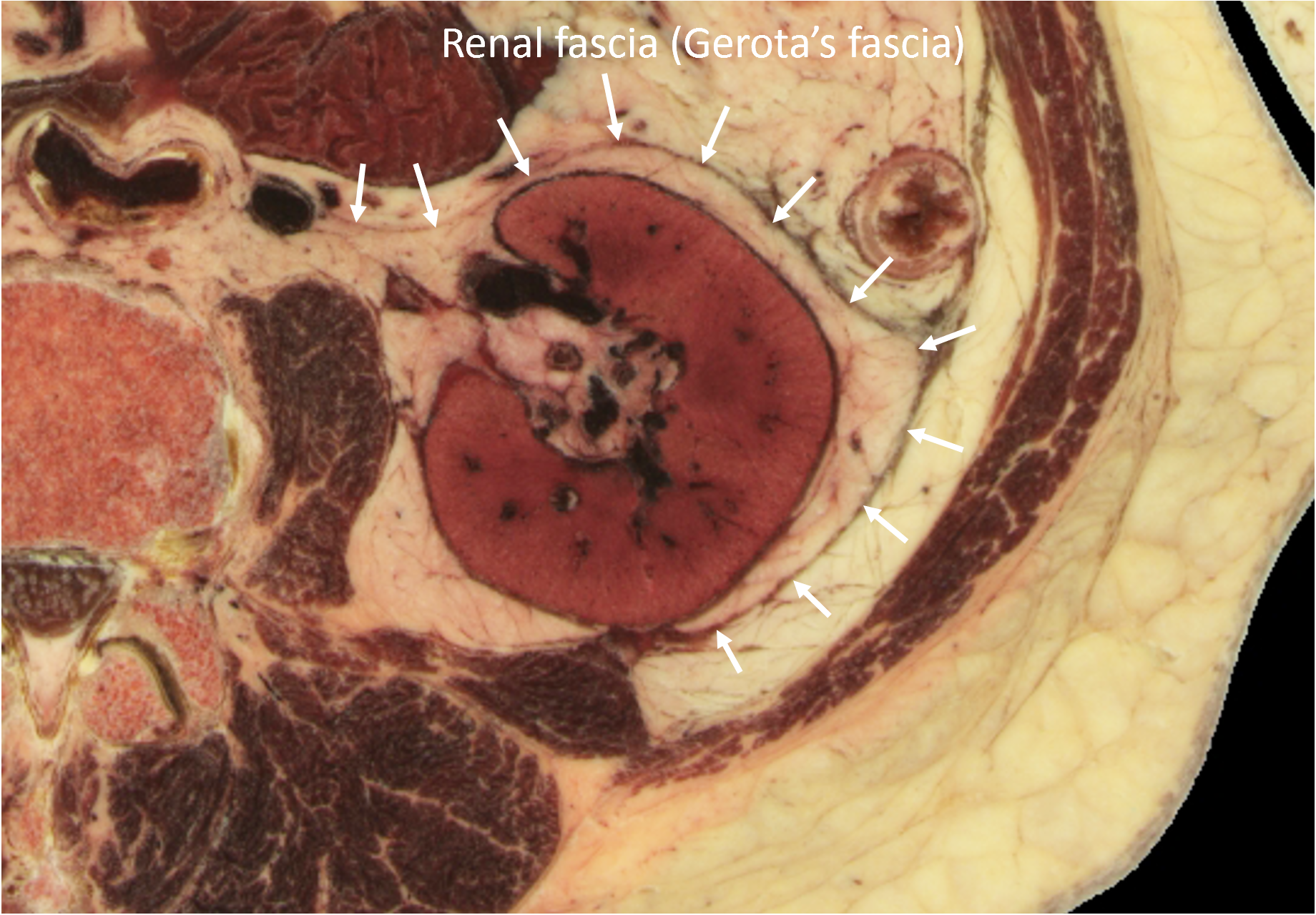 renal fascia anatomy