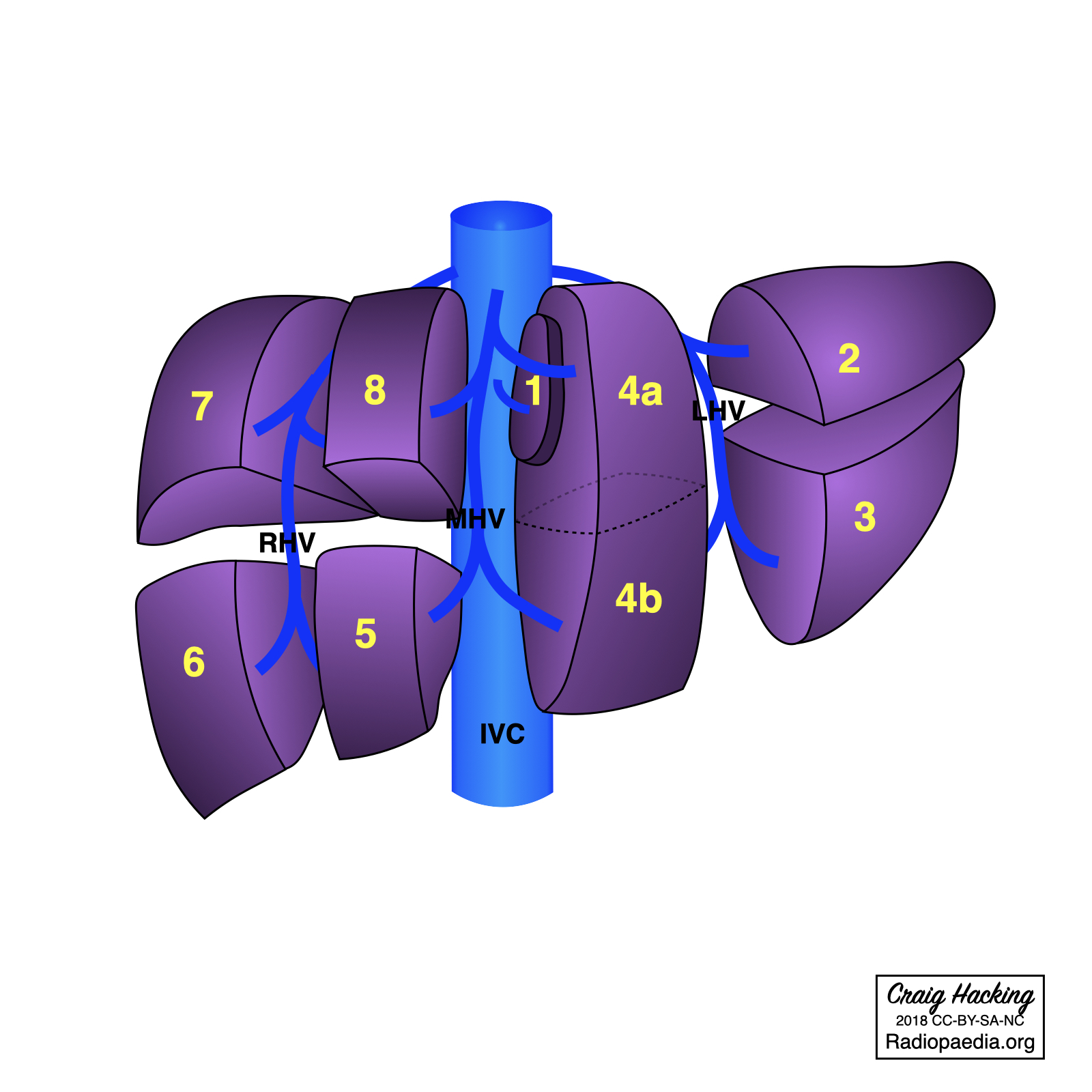 Radiopaedia - Drawing Hepatic segments - English labels | AnatomyTOOL