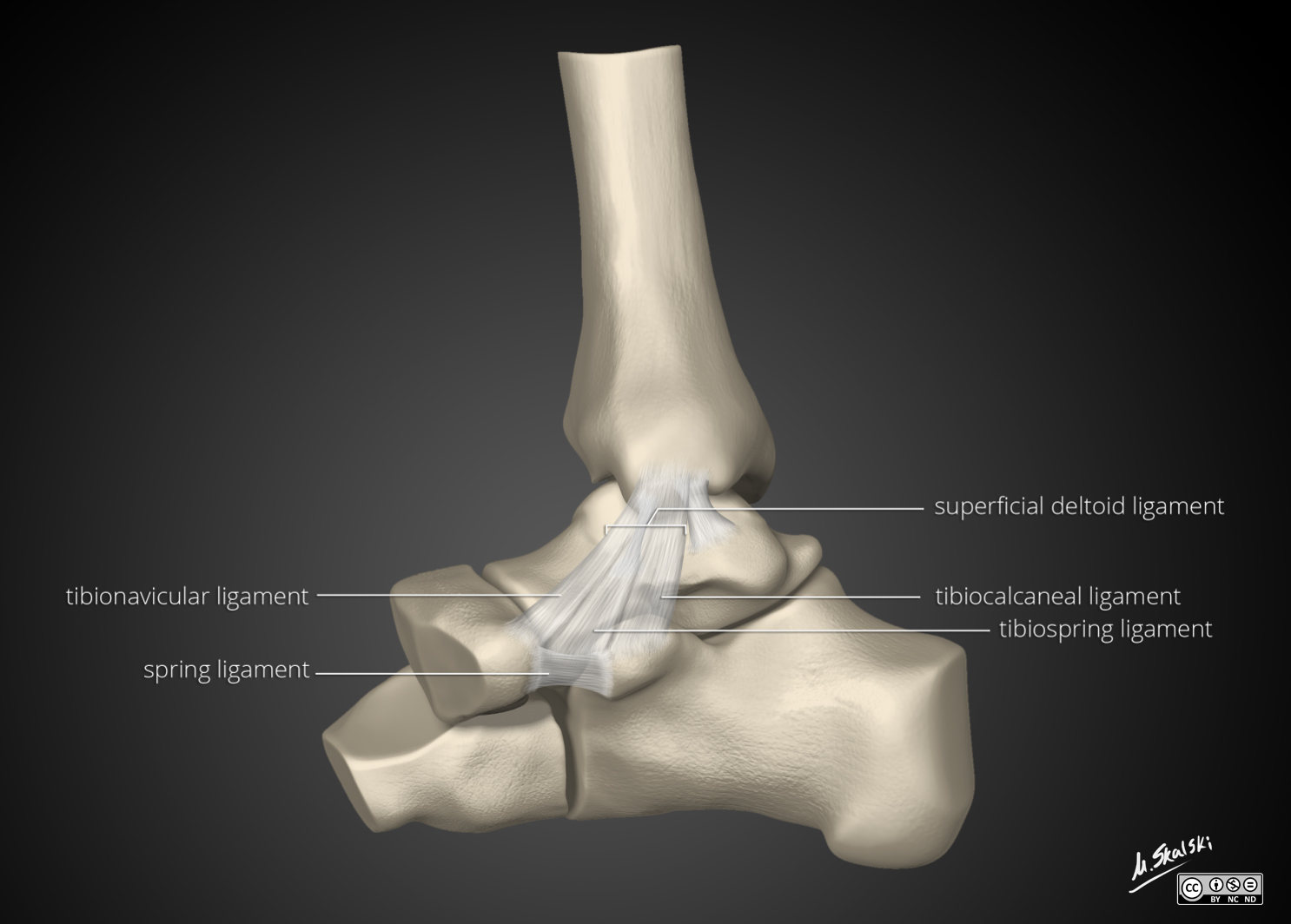 Radiopaedia Drawing Deltoid ligament of ankle superficial layer