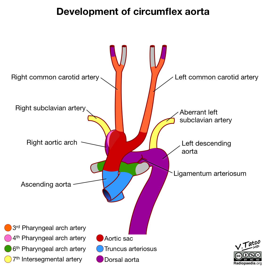 Radiopaedia - Drawing Development of circumflex aorta - English labels ...