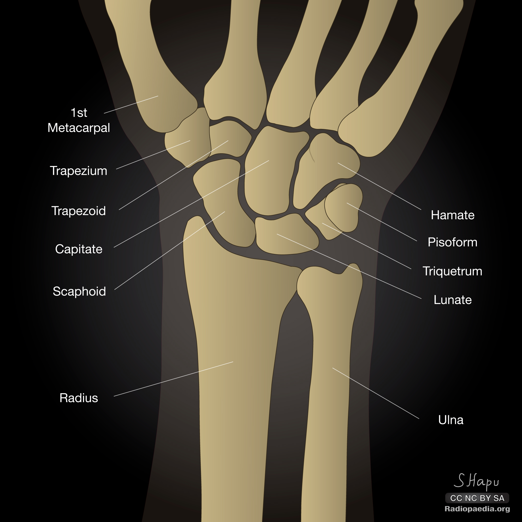 Radiopaedia - Drawing Carpal bones volar view - English labels ...