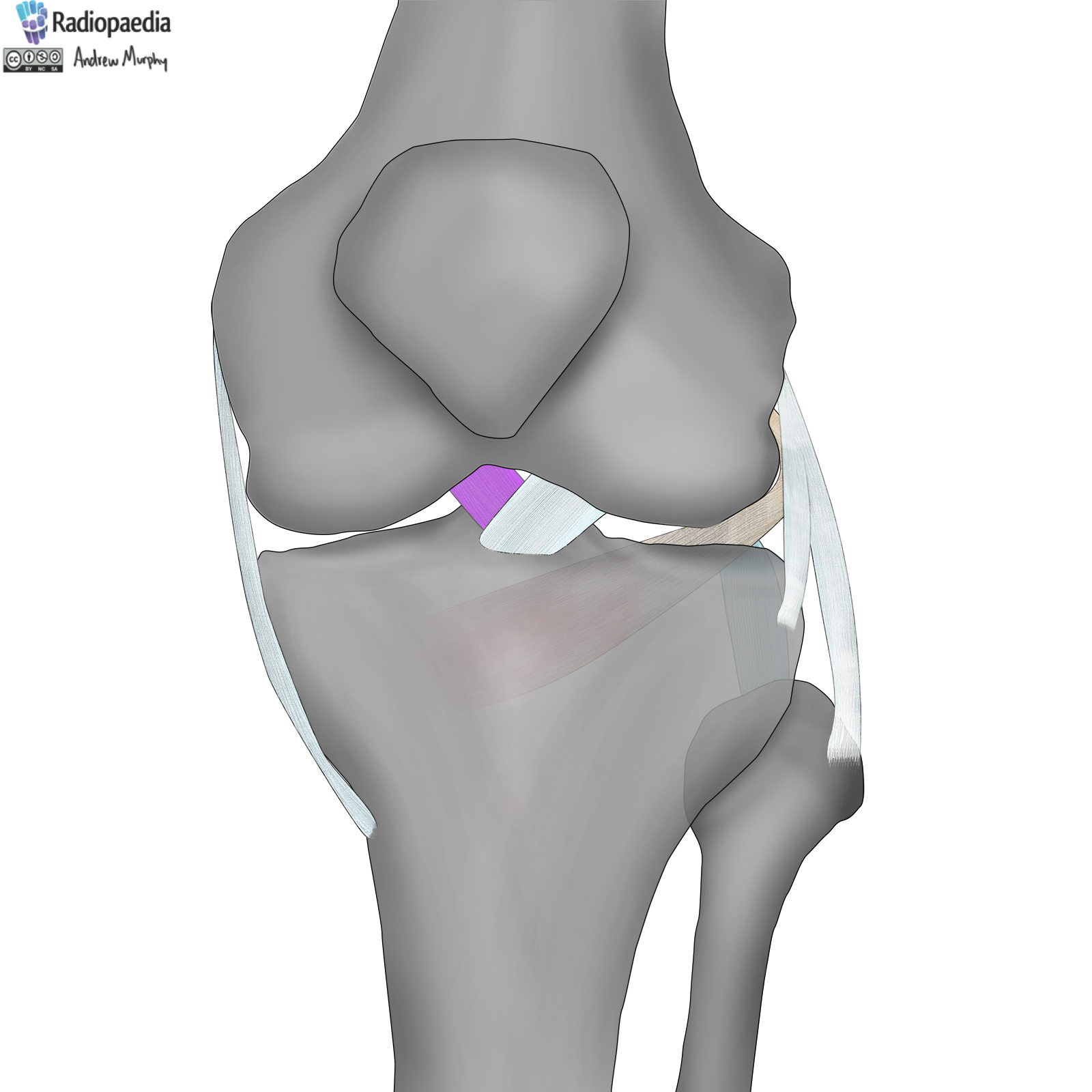 Radiopaedia - Drawing Ligaments of the knee joint - no labels | AnatomyTOOL