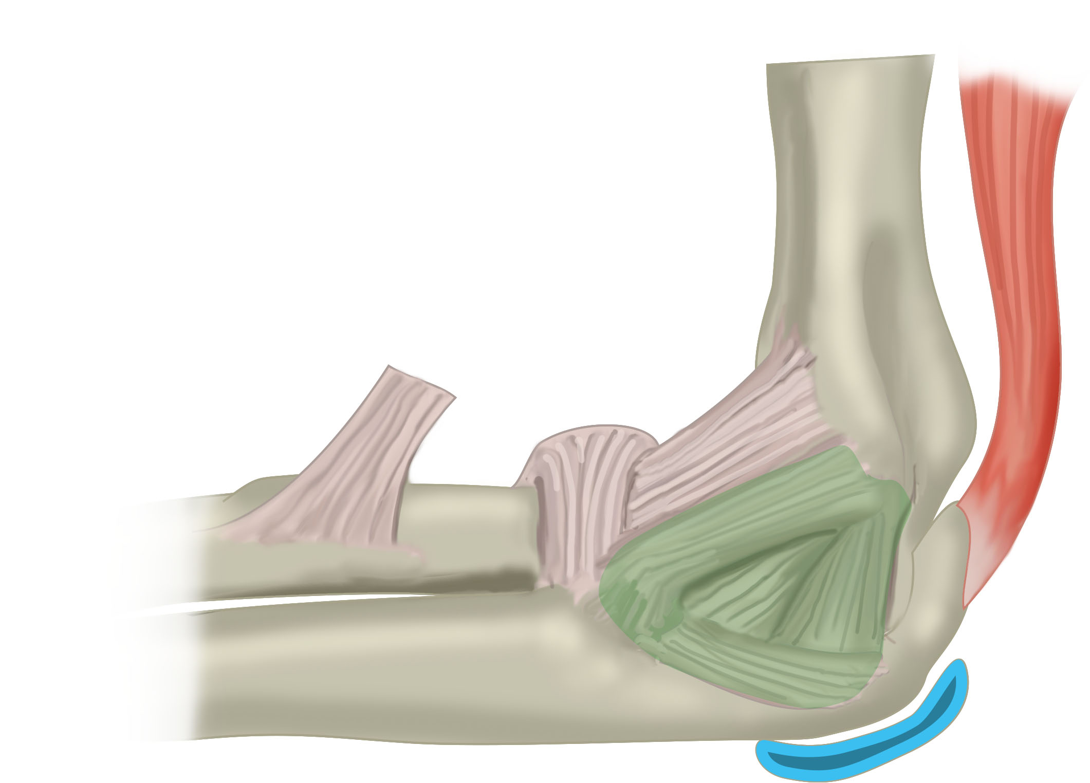 Slagter - Drawing Ulnar nerve compression around the elbow - Dutch labels
