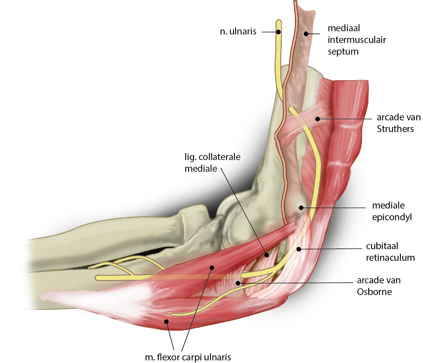 Slagter - Drawing Ulnar nerve compression around the elbow - Dutch labels