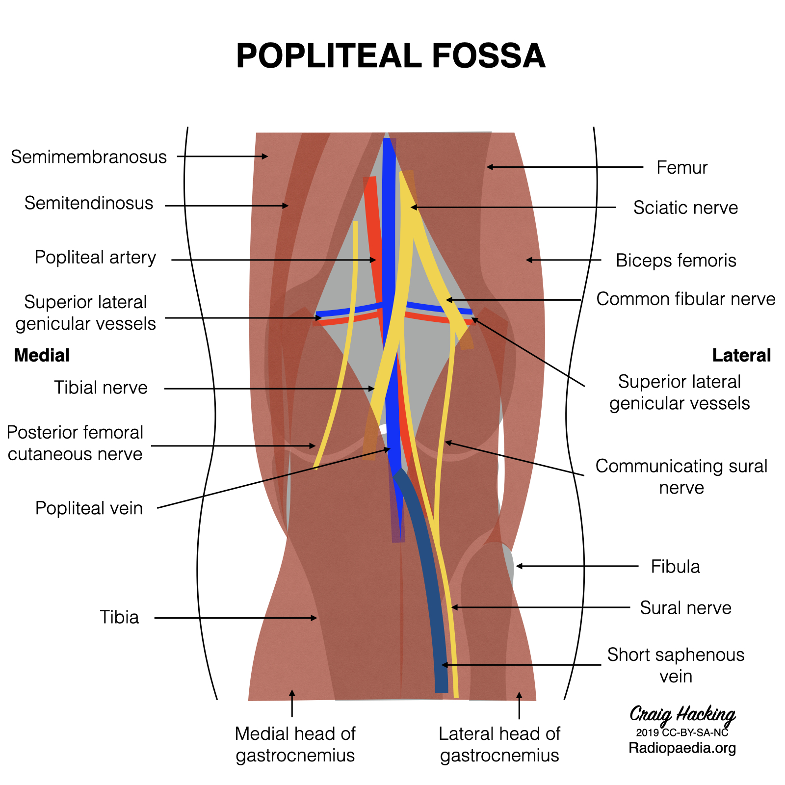 Radiopaedia Drawing Contents Of The Popliteal Fossa English Labels