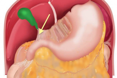 Anatomy of the Stomach Quiz