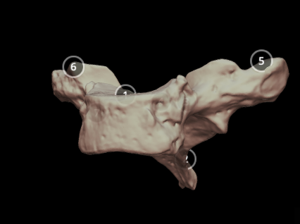 BlueLink - 3D model First Thoracic Vertebra (T1)