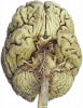 U.Br.Columbia - Photo Inferior brain: cranial nerves (dissection) - no labels