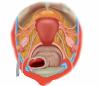 Superior view of female pelvis and surrounding endopelvic fascia – no labels
