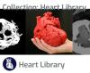 thumb NIH 3D print exchange website 3D Heart models