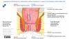 Leiden - Drawing Difference in neurovascular connections superior and inferior of pectinate line - Latin and English labels