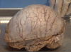 Utah Neuroanatomy Video Lab - Meninges