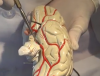 Utah Neuroanatomy Video Lab - Cerebral Circulation
