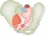 Tendinous Arch of Levator Ani, Tendinous Arch Of Pelvic Fascia And Ligaments Of Female Pelvis - no labels