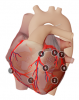 Thumb 3D model Heart with Right Dominance