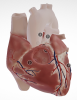 Thumb link to page 3D models of congenital heart diseases