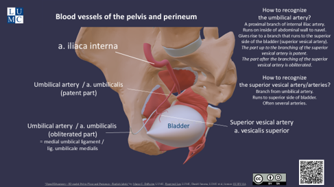 Presentation: pelvis - blood vessels