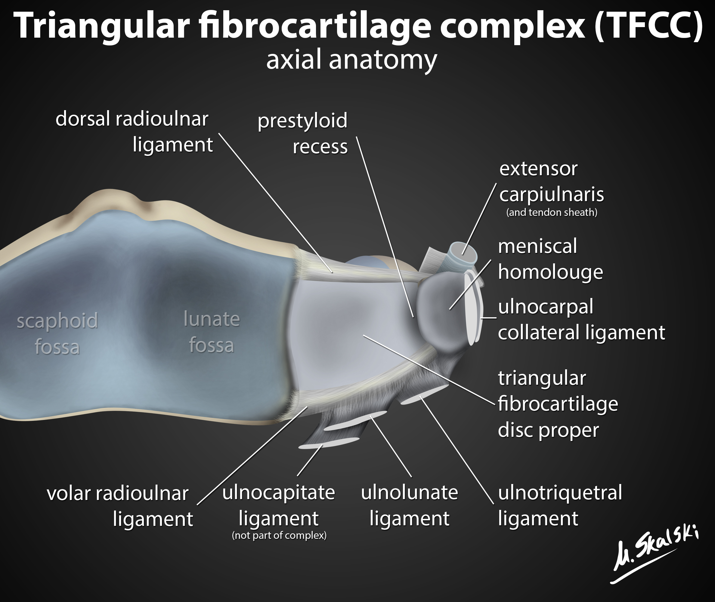 Radiopaedia Drawing Triangular fibrocartilage complex English