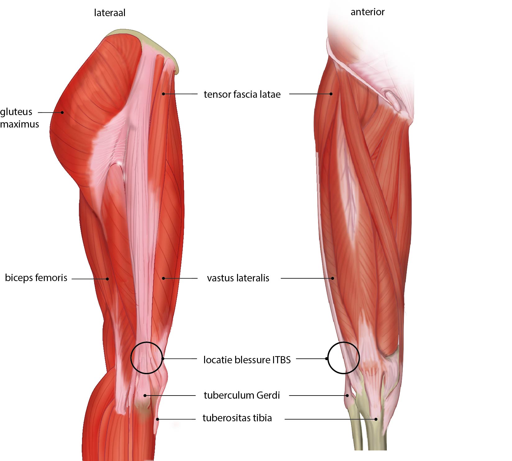 Slagter - Drawing Lateral and anterior view of muscles of thigh and  location Iliotibial band syndrome - Dutch labels