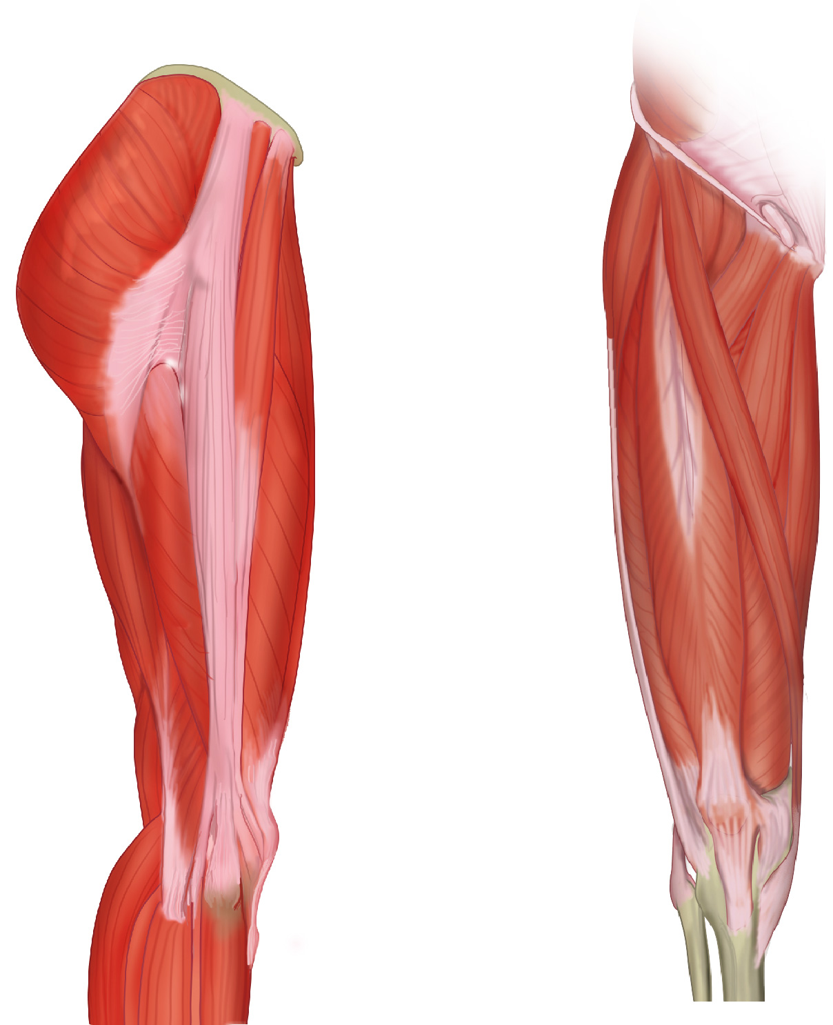 Slagter - Drawing Lateral and anterior view of muscles of thigh and  location Iliotibial band syndrome - Dutch labels